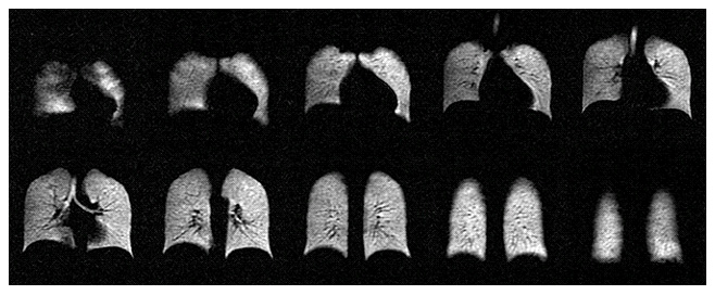 Images of healthy human lungs